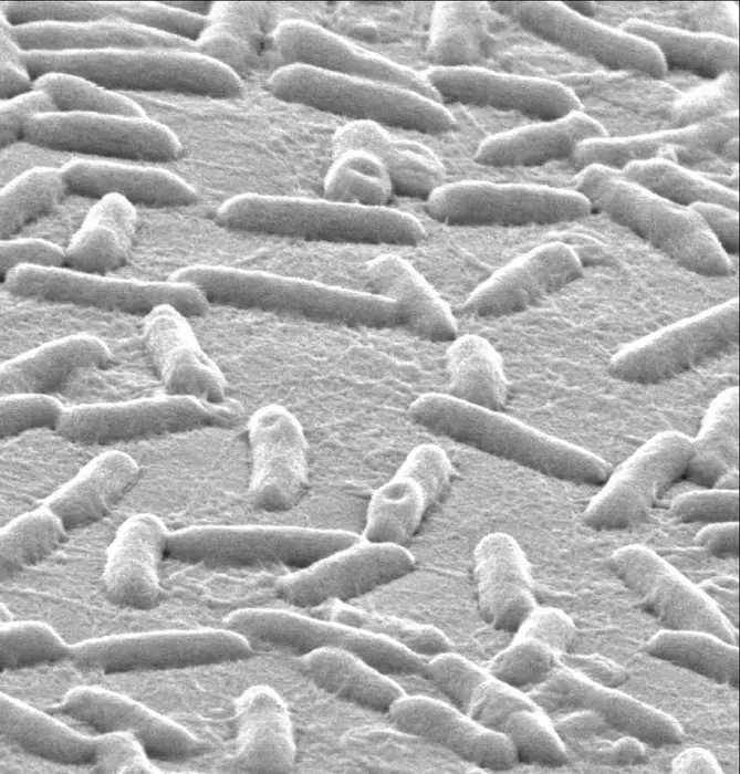 An electromicrograph of Pseudomonas aeruginosa, showing its sausage shape An electromicrograph of Pseudomonas aeruginosa, showing its sausage shape